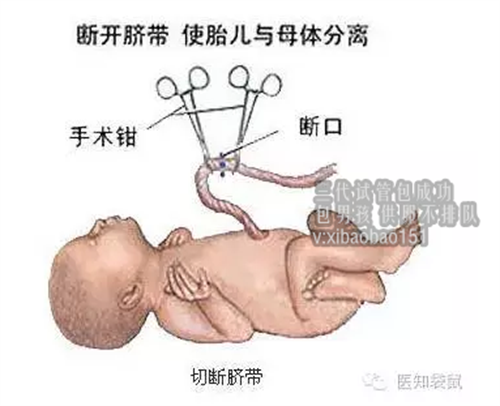 上海祈新生殖供卵试管_促黄体生成素与黄体生成素区别